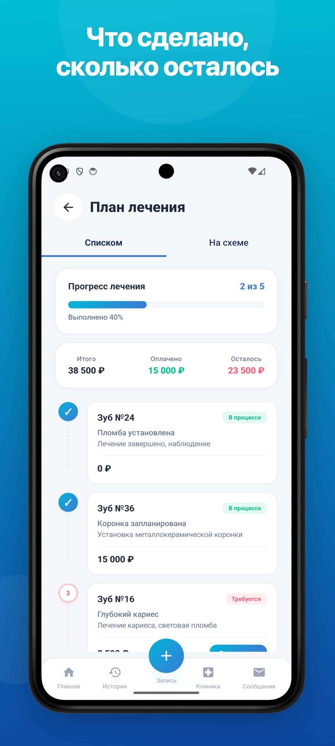 Прогресс лечения — что сделано, сколько осталось